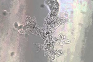 Tratamiento para amibiasis